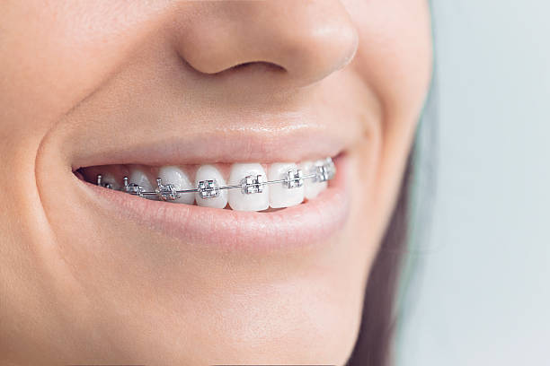 Best Wisdom Tooth Removal  in Senoia, GA